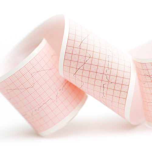 Arrhythmia procedures used to treat atrial fibrillation