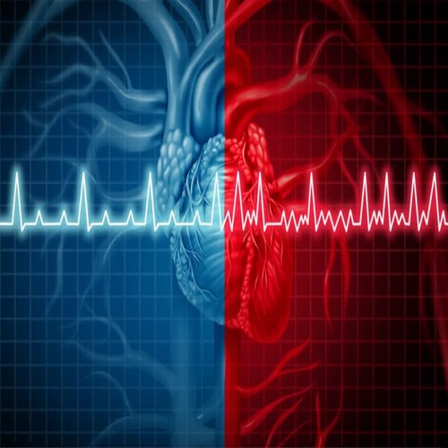 Patient recovering after atrial fibrillation ablation