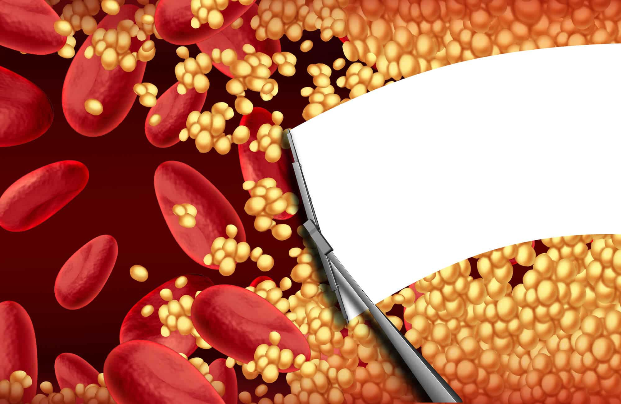 Anticoagulation therapy risks and benefits in atrial fibrillation