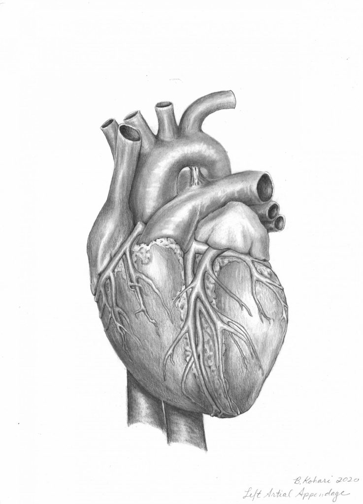 FAF_LeftAtrial_Appendage_Illustration_7-29-20-scaled